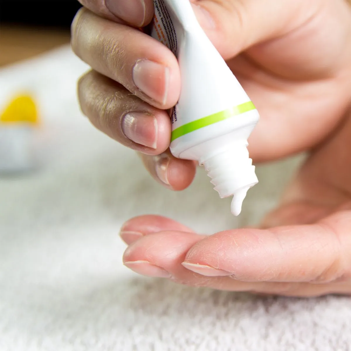Anti-Scar Ointments