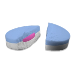 Bi-layered Tablet-in-Tablet