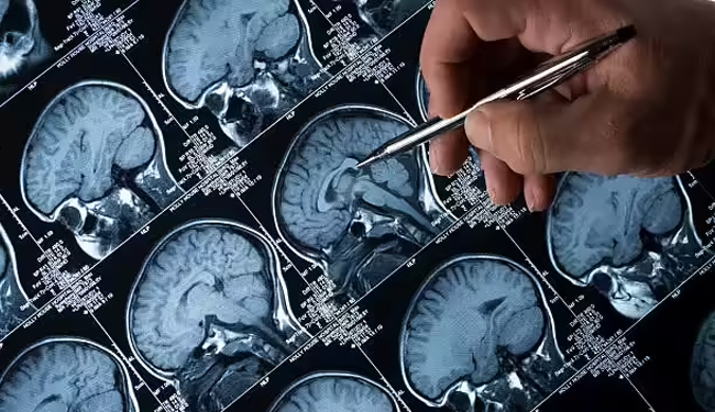 Akums Receives DCGI Approval for Perampanel Oral Suspension